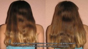 Крапива для роста волос: как справиться с облысением и оздоровить волосы