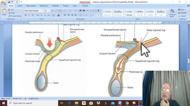 Anatomy GIT module in English 2020 ( Anatomical principles of inguinal hernia ) , by Dr. Wahdan смотреть онлайн