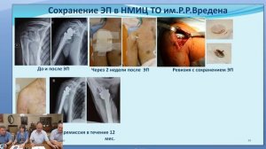 Перипротезная инфекция Вебинар 17 июня в 16-00 (MSK).mp4