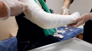 Как накладывать "пластиковый гипс" после вывиха предплечья