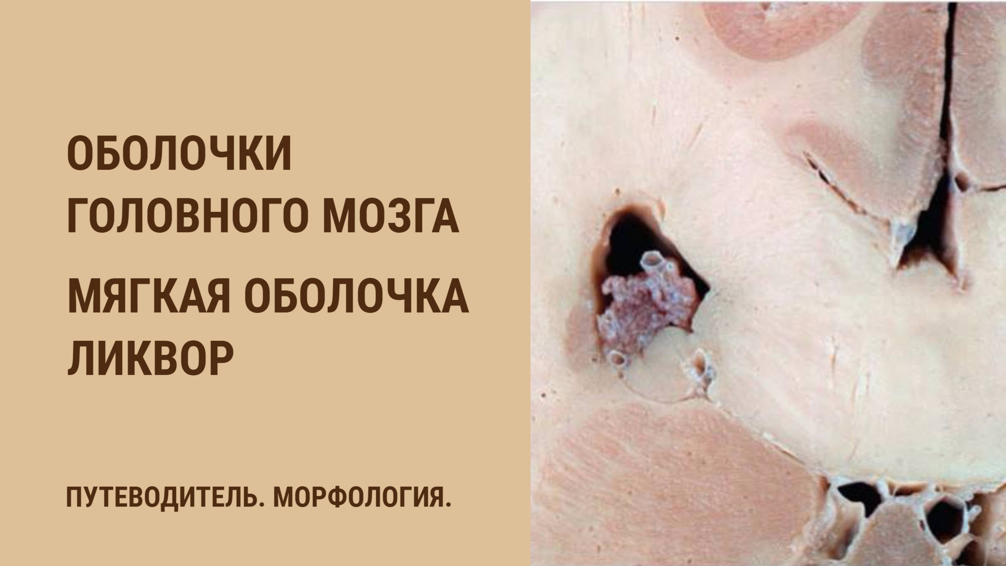 Оболочки головного мозга. Мягкая оболочка. Ликвор