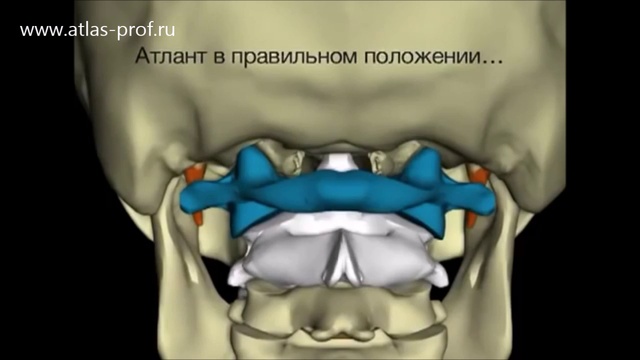 Правка атланта