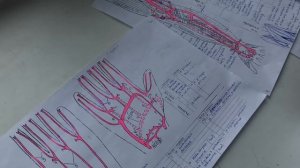 Подмышечная артерия. Артерии верхней конечности. Брюшная аорта.