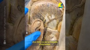 Ils font des vidéos avec des CADAVRES pour enseigner l'anatomie