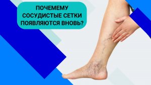 ПОЧЕМУ СОСУДИСТЫЕ СЕТКИ ПОЯВЛЯЮТСЯ ВНОВЬ?