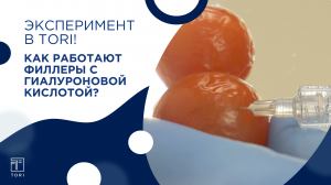 Действие филлеров с гиалуроновой кислотой: наглядный эксперимент от врача-косметолога