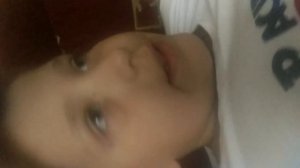 Мне попали нос