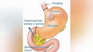 Острая боль в  желудке                Какие  причины?