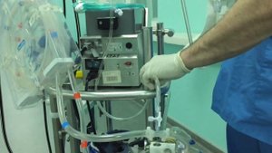 Сборка апарата ЭКМО ECMO Maquet System