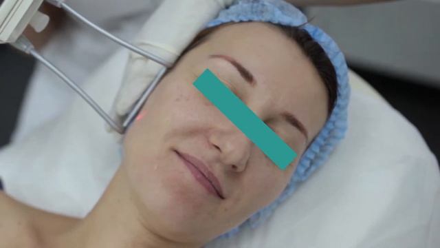 МЭЦ "Эликсир". Лазерное омоложение FRAC3 T3 смотреть онлайн