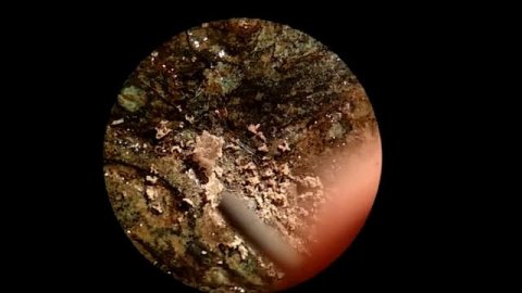 Механическая чистка монеты,аверс,антика