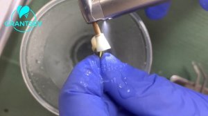 Коронка на имплант. Фиксация прикручиваемой коронки двойной фиксации на имплант Antogyr