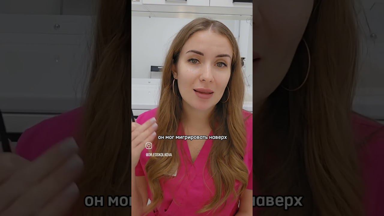 гиалуроновые усы #shortsvideo #shortsvideo #советыврача #гиалуронка  #косметология #увеличениегуб
