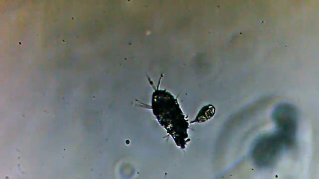 микробы под микроскопом , видео с веб-камеры кто-то кого-то ест микробы смотреть онлайн