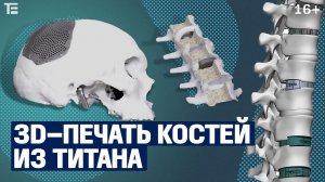 Российская компания печатает кости! Медицинская 3D-печать титановых имплантов