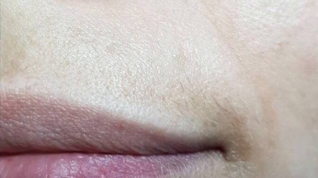 ЭЛЕКТРОЭПИЛЯЦИЯ НАРИНЕ смотреть онлайн