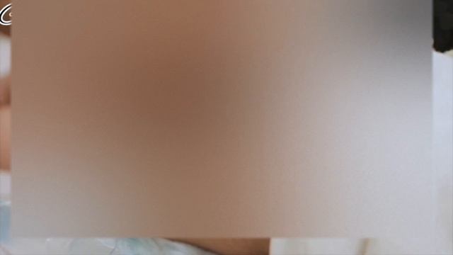 Дисплазия деген не? #дисплазия.Балалар арасындағы дисплазия. Дисплазия тазобедренных суставов