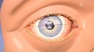 Профилактика симптомы и лечение конъюнктивита