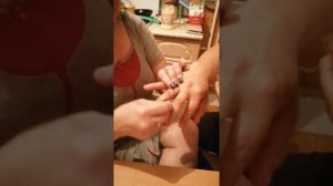 Как снять кольцо с опухшего пальца)) самый простой способ