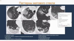 Искусственный интеллект и реальная медицинская практика: диалог с врачом