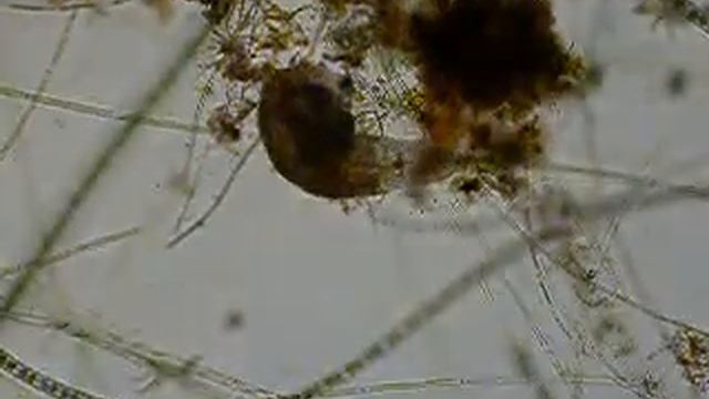Rotaria sp. (Fam. Philodinidae; F. Rotifera) смотреть онлайн