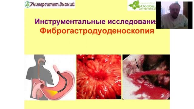 Заболевания ЖКТ: Язвенная болезнь желудка и 12 перст кишки. А. Данилко 28.02.2016 
