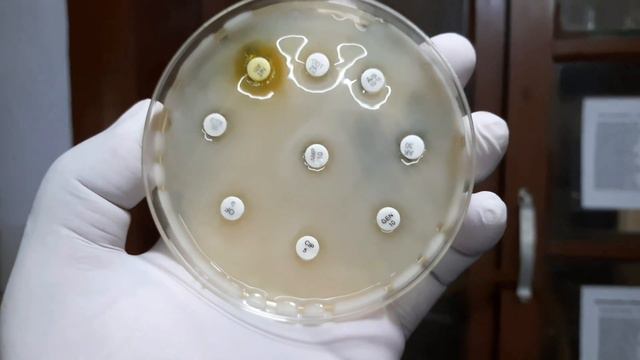 Klebsiella colony characteristics, Gram Stain,Biochemical Tests, Antimicrobial sensitivity testing смотреть онлайн