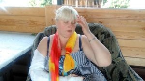 Допрыгалась! перелом локтевого сустава, головки лучевой кости. Ч1.
