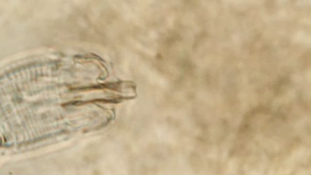 червь волосатик ужасный паразит! смотреть онлайн