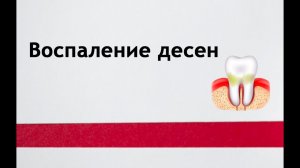 Воспаление десен - причины, лечение, советы стоматолога