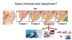 Рева Сергей Александрович. Рак простаты: профилактика, выявление и лечение. "Про_Жизнь".Виталогия.