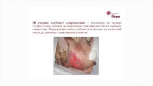 18. Мастерская заботы: Профилактика пролежней