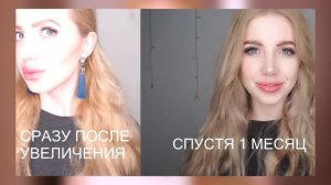 НЕ КОЛИТЕ ГУБЫ!!! ПОСЛЕДСТВИЯ УВЕЛИЧЕНИЯ ГУБ СПУСТЯ 6 ЛЕТ