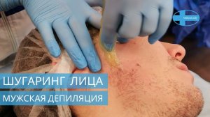 Мужская сахарная депиляция Зона лица. Обучение с сертификатом. Видео курс Мужской шугаринг лица