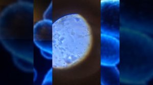 Дрожжи в сахарной воде под микроскопом 640х