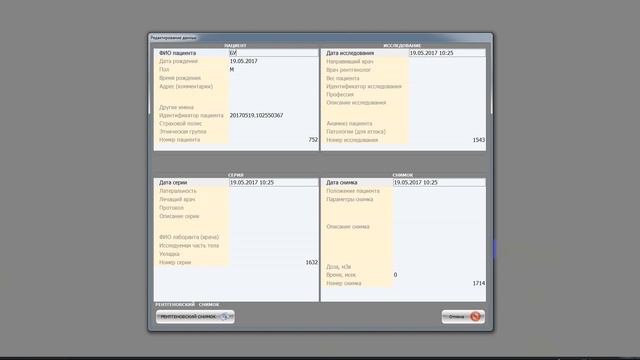 Работа программного обеспечения для обработки рентгеновского изображения 1 смотреть онлайн