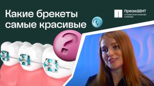 👄 Брекеты: какие виды, в чем разница, как устанавливают? Брекеты виды и разница.