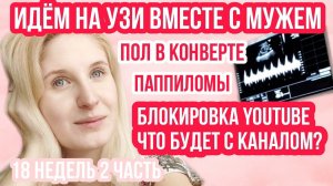 УЗИ ВО ВТОРОМ ТРИМЕСТРЕ ◈ ВПЧ ◈ ПОЛ ◈ 18 неделя беременности 2 Часть ◈ Влоги беременной Сашки