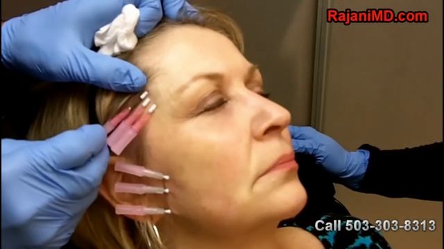 PDO Threads-Eye Lift-DR Rajani смотреть онлайн