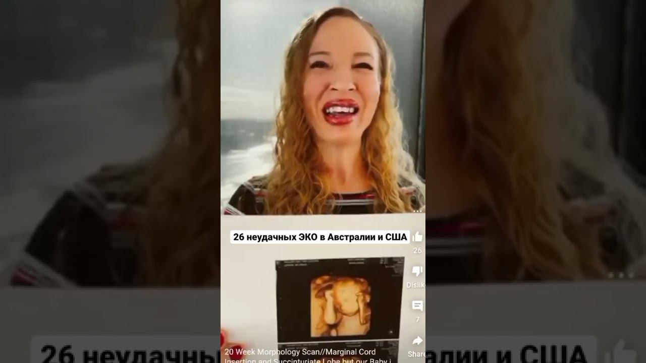 Реально ли родить после 26 неудачных ЭКО? shorts
