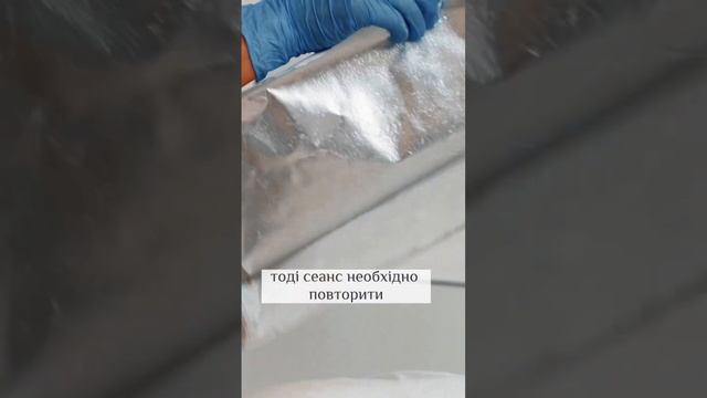 -5 см за 1 сеанс! Медичний кріоліполіз CRISTAL ?#схуднення#похудение#похудениедопосле#допосле
