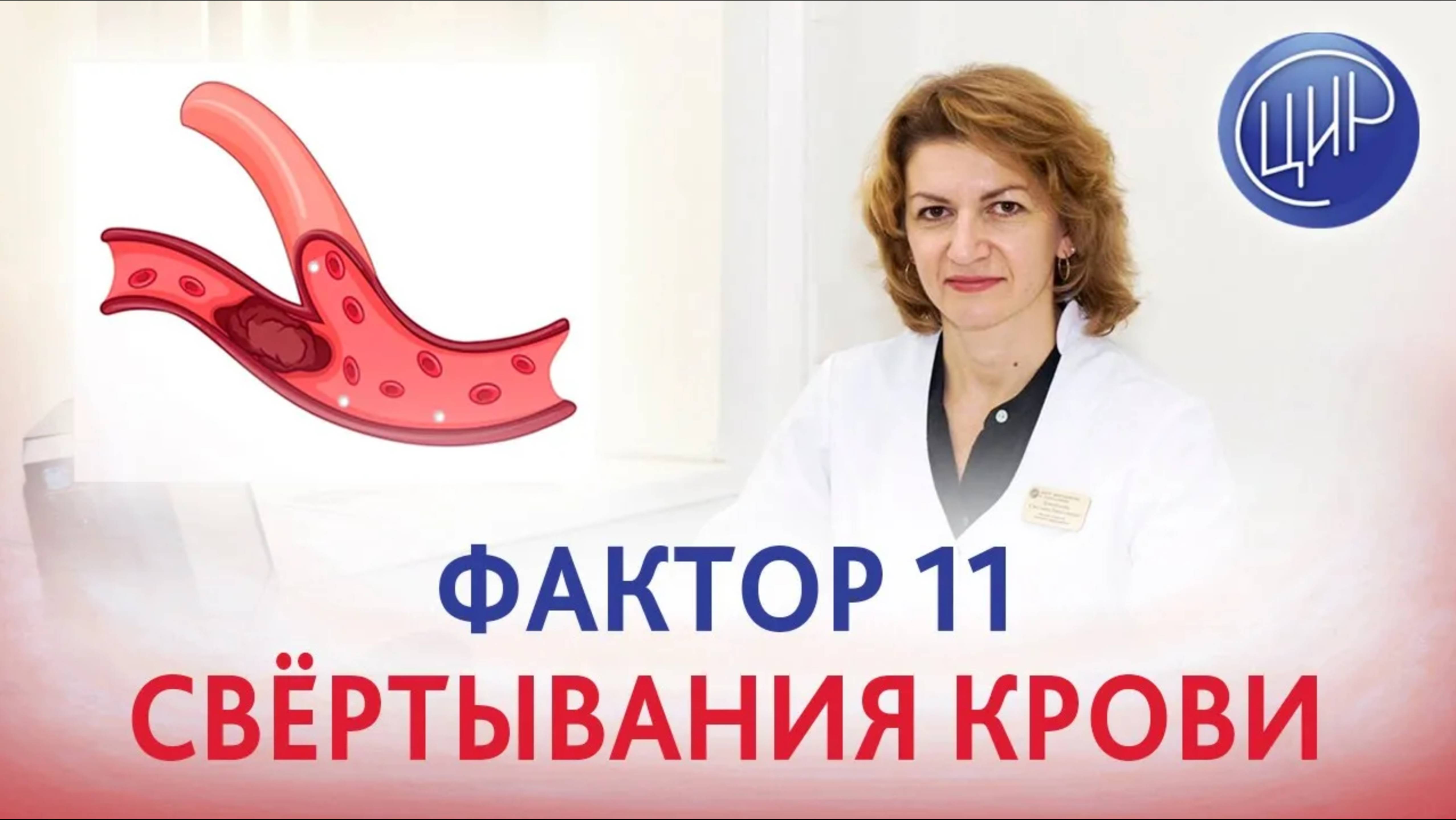 Фактор 11 свёртывания крови и риск тромбоза. Дементьева С.Н.