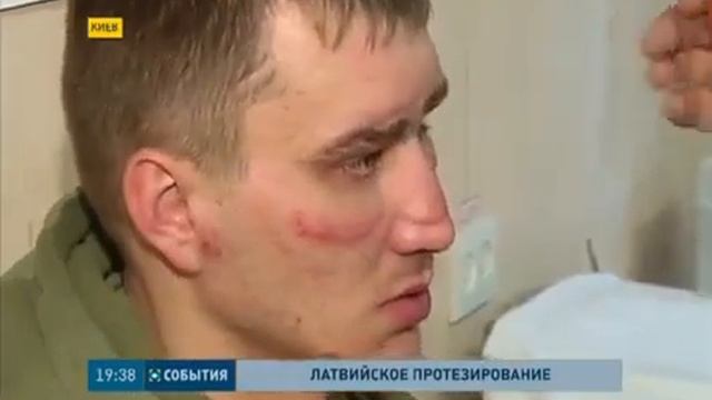 Ранен минус. Ранен минус. Ранен минус. Санни кросс. Ранен минус.