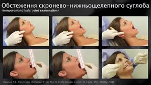 Анатомия и обследования ВНЧС ( височно нижнечелюстной сустав )
