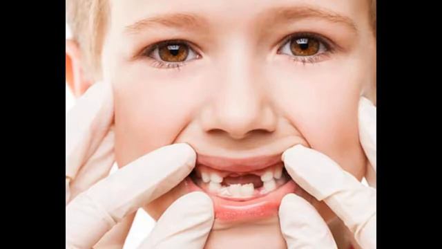 Зачем человеку молочные зубы? смотреть онлайн