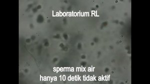 SPERMA TIDAK AKTIF DALAM AIR  Video Labor RL