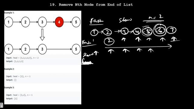 19 Remove Nth Node From End of List | Leetcode 19 | Java  | Solution | LinkedList | Two Pointer