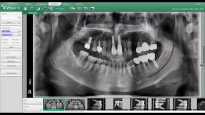 Demo EzDent i