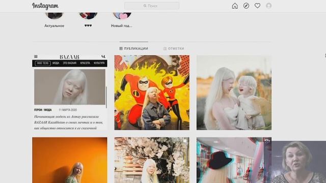 У казахов родились 2 необычные девочки-альбиносы. Как сложилась их судьба. смотреть онлайн