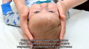 Большая голова у новорожденного — причины, болезнь